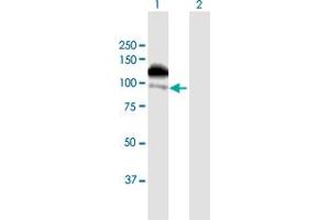 Image no. 2 for anti-Zinc Finger, FYVE Domain Containing 16 (ZFYVE16) (AA 1-809) antibody (ABIN948847)