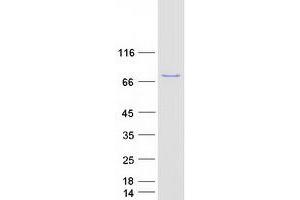 Image no. 1 for Plastin 1 (PLS1) (Transcript Variant 2) protein (Myc-DYKDDDDK Tag) (ABIN2729116)