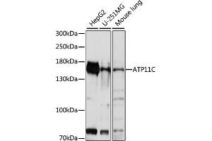 ATP11C anticorps  (AA 430-650)