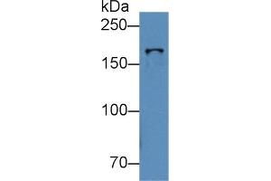 TOP2B antibody  (AA 446-655)