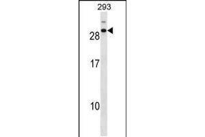 Image no. 1 for anti-Cell Division Cycle Associated 4 (CDCA4) (AA 163-190), (C-Term) antibody (ABIN5530898)