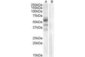 Image no. 1 for anti-Arylsulfatase D (ARSD) (Internal Region) antibody (ABIN263179)