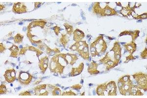 Immunohistochemistry of paraffin-embedded Human stomach using VAPA Polyclonal Antibody at dilution of 1:100 (40x lens).