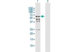 Image no. 2 for anti-PDZ Domain Containing 3 (PDZD3) (AA 1-491) antibody (ABIN949657)