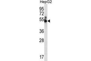 Image no. 1 for anti-Diphthamide Biosynthesis 7 (DPH7) (AA 32-51), (N-Term) antibody (ABIN955566)