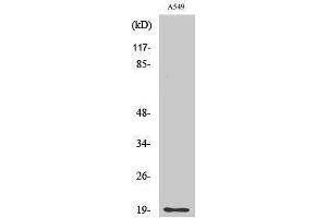 Image no. 1 for anti-CD3d Molecule, delta (CD3-TCR Complex) (CD3D) (Internal Region) antibody (ABIN3183769)