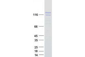 Image no. 1 for Synaptotagmin Like Protein 2 (SYTL2) (Transcript Variant A) protein (Myc-DYKDDDDK Tag) (ABIN2733138)