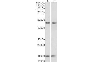 Image no. 3 for anti-Patatin-Like phospholipase Domain Containing 3 (PNPLA3) (Internal Region) antibody (ABIN361184)