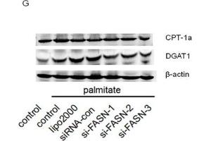 Image no. 1 for anti-Carnitine Palmitoyltransferase 1A (Liver) (CPT1A) antibody (ABIN6138976)