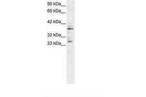 Image no. 1 for anti-Sirtuin 5 (SIRT5) (C-Term) antibody (ABIN6735783)