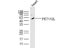 Image no. 2 for anti-PET112 Homolog (PET112) (AA 101-200) antibody (ABIN1385899)