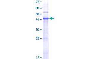 PTOV1 Protein (AA 1-416) (GST tag)