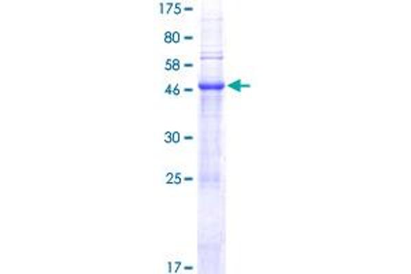 PTOV1 Protein (AA 1-416) (GST tag)