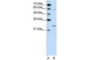 Image no. 1 for anti-Guanidinoacetate N-Methyltransferase (GAMT) (N-Term) antibody (ABIN2776937)