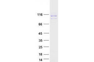 Image no. 1 for Ribosome Binding Protein 1 (RRBP1) (Transcript Variant 1) protein (Myc-DYKDDDDK Tag) (ABIN2731196)