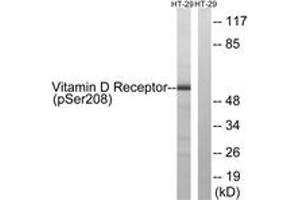 Western blot analysis of extracts from HT29 cells treated with heat shock, using Vitamin D Receptor (Phospho-Ser208) Antibody.