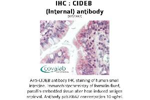 Image no. 1 for anti-Cell Death-Inducing DFFA-Like Effector B (CIDEB) (Internal Region) antibody (ABIN1733097)