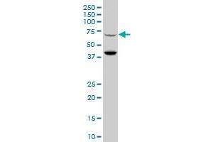 RNF157 polyclonal antibody (A01), Lot # 051114JC01 Western Blot analysis of RNF157 expression in Y-79 .