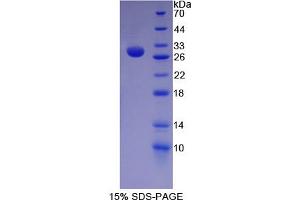 Image no. 1 for Hes Family bHLH Transcription Factor 1 (HES1) (AA 21-251) protein (His tag) (ABIN6238293)