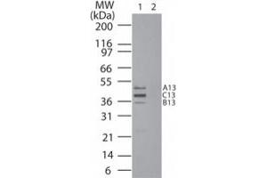 Image no. 1 for anti-Homeobox B13 (HOXB13) (AA 232-249) antibody (ABIN957354)