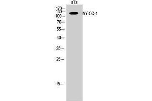 Image no. 1 for anti-serologically Defined Colon Cancer Antigen 1 (SDCCAG1) (C-Term) antibody (ABIN3185981)