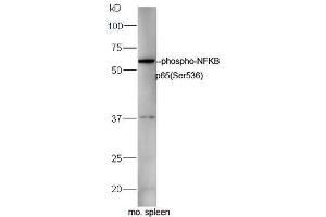 Image no. 5 for anti-Nuclear Factor-kB p65 (NFkBP65) (pSer536) antibody (ABIN730528)