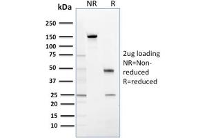 Image no. 4 for anti-Stratifin (SFN) antibody (ABIN6939540)
