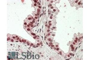 Image no. 2 for anti-Homeobox D13 (HOXD13) (Internal Region) antibody (ABIN570834)