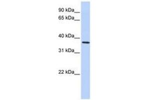 Image no. 1 for anti-F-Box Protein 8 (FBXO8) (AA 216-265) antibody (ABIN6741269)