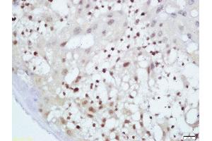 Image no. 1 for anti-V-Maf Musculoaponeurotic Fibrosarcoma Oncogene Homolog (Avian) (MAF) (AA 341-403) antibody (ABIN760631)