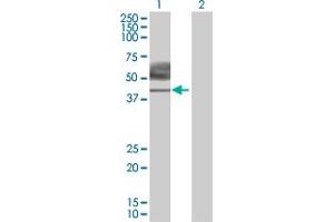 Image no. 1 for anti-Interleukin 10 Receptor, beta (IL10RB) (AA 1-325) antibody (ABIN517091)