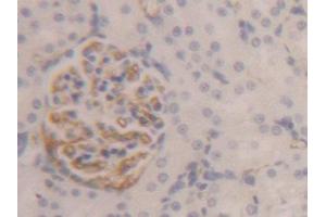 Image no. 3 for anti-Fibrinogen beta Chain (FGB) (AA 33-479) antibody (ABIN1174356)