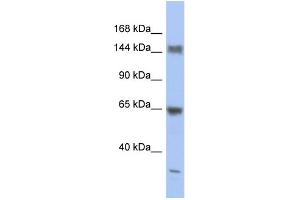Image no. 1 for anti-Ataxin 2 (ATXN2) (Middle Region) antibody (ABIN2780458)