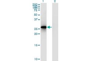 Image no. 2 for anti-Ribonuclease P/MRP 30kDa Subunit (RPP30) (AA 169-268) antibody (ABIN564608)