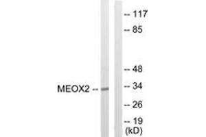 Image no. 1 for anti-Mesenchyme Homeobox 2 (MEOX2) (AA 151-200) antibody (ABIN1533753)