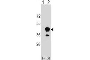 Image no. 2 for anti-CD1b (CD1B) (AA 57-85) antibody (ABIN3030367)