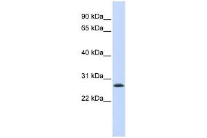 Image no. 1 for anti-LSM12 Homolog B (LSM12B) (Middle Region) antibody (ABIN2785147)