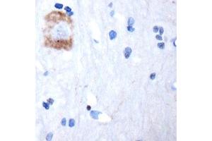 Image no. 11 for anti-Transient Receptor Potential Cation Channel, Subfamily M, Member 8 (TRPM8) (1st Cytoplasmic Loop) antibody (ABIN571644)
