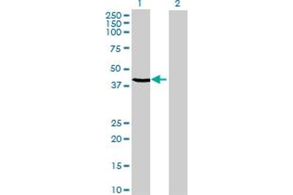 anti-Chromosome 20 Open Reading Frame 4 (C20orf4) (AA 1-384) antibody