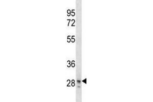 Image no. 1 for anti-Snail Homolog 3 (SNAI3) (AA 1-29) antibody (ABIN3029022)