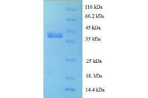 Image no. 1 for Ribosomal Protein L28 (RPL28) (AA 2-137) protein (GST tag) (ABIN5710274)