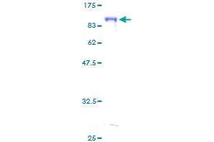 Human Alveolar Soft Part Sarcoma Chromosome Region Candidate 1 Aspscr1 Protein Gst Recombinant Abin