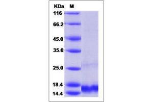 Image no. 1 for Chemokine (C-C Motif) Ligand 7 (CCL7) (AA 24-97) protein (His tag) (ABIN2650242)