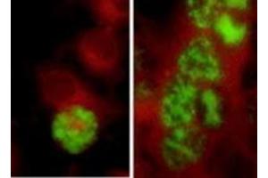 Image no. 2 for anti-Herpes Simplex Virus ICP5 (HSV ICP5) antibody (ABIN265570)