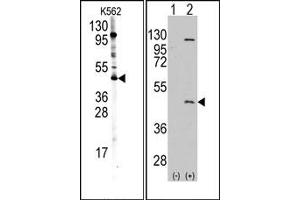 Image no. 1 for anti-Protein Arginine Methyltransferase 8 (PRMT8) (C-Term) antibody (ABIN356732)