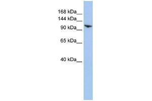 Image no. 1 for anti-Ring Finger Protein 20 (RNF20) (N-Term) antibody (ABIN2774763)