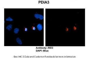 Image no. 5 for anti-Protein Disulfide Isomerase Family A, Member 3 (PDIA3) (C-Term) antibody (ABIN2774375)