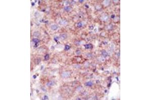 Image no. 2 for anti-SMAD Specific E3 Ubiquitin Protein Ligase 2 (SMURF2) (C-Term) antibody (ABIN357472)