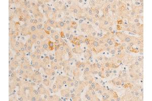 Image no. 9 for anti-Nuclear Factor-kB p65 (NFkBP65) (pSer536) antibody (ABIN6255402)
