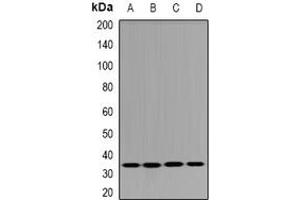 Image no. 2 for anti-Dehydrogenase/reductase (SDR Family) Member 9 (DHRS9) (full length) antibody (ABIN6043388)